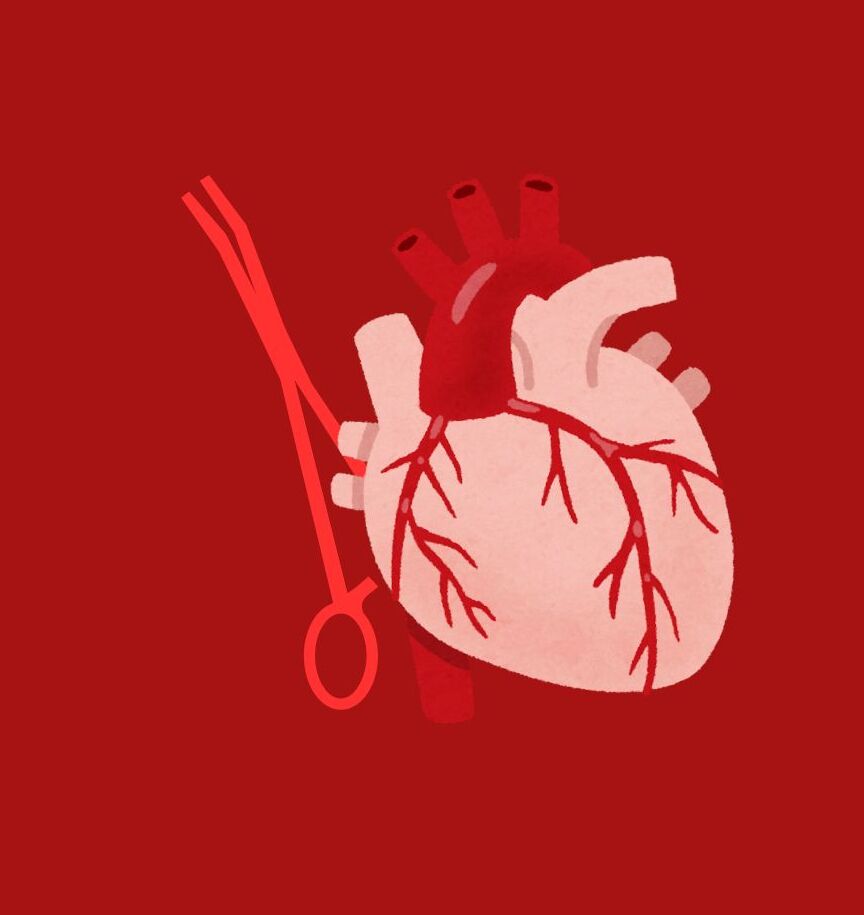 Cirugía cardiovascular